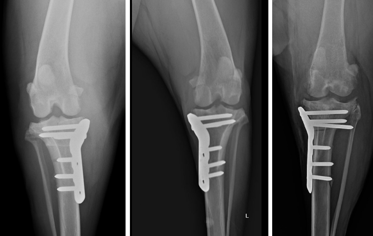 一張含有 X 光影像, 醫學影像, X 光照相術, X 光 的圖片AI 產生的內容可能不正確。
