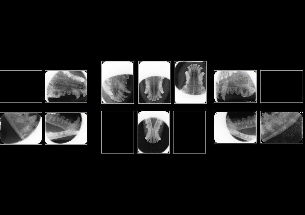 X-ray images of human teethAI-generated content may be incorrect.